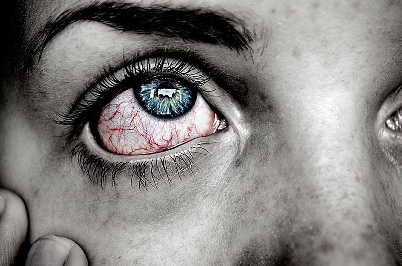 Bloodshot Eyes
